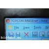 Topcon SP-3000P Specular Microscope