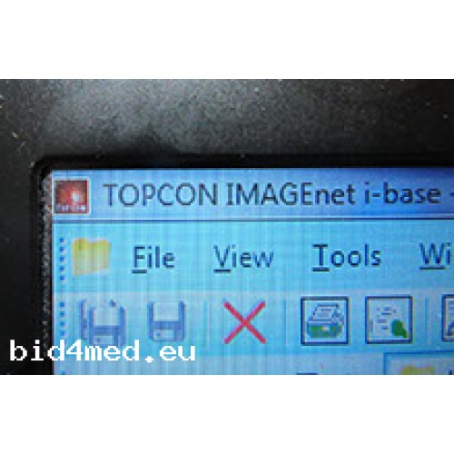 Topcon SP-3000P Specular Microscope